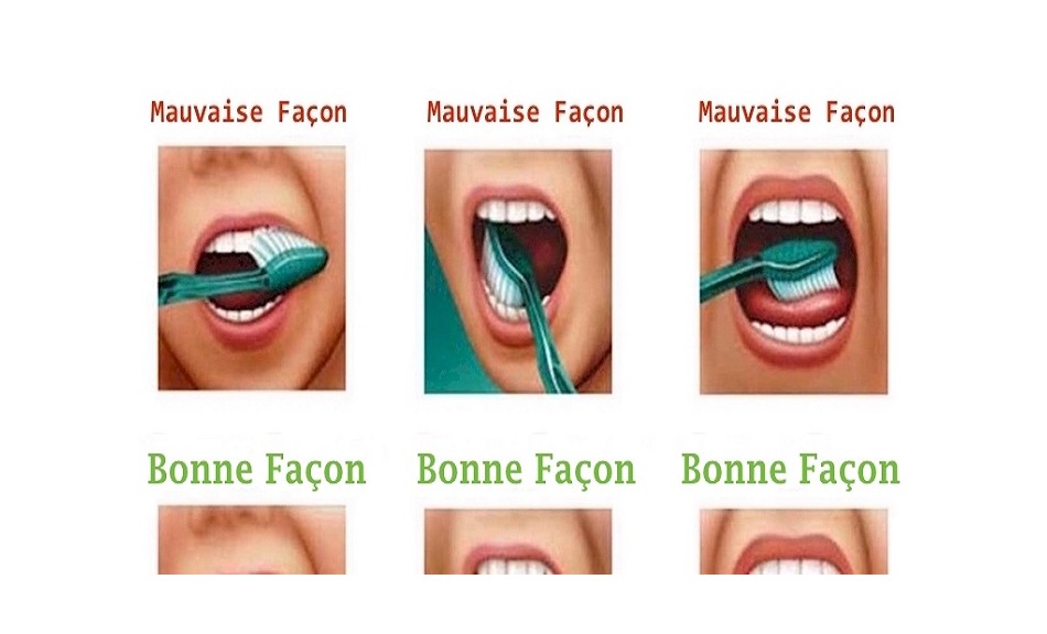 Comment bien se brosser les dents (vidéo)